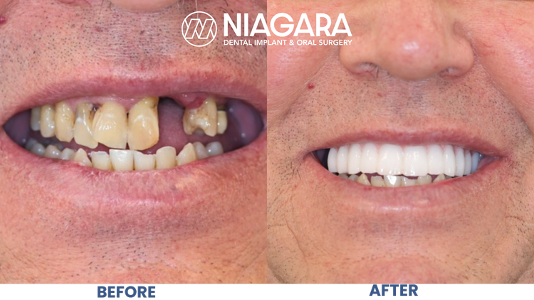 Comparison of teeth before and after dental treatment, showing improved teeth alignment and whitening, with the before image showing misaligned and discolored teeth and the after image showing straight, white teeth. The image is branded for NDIOS