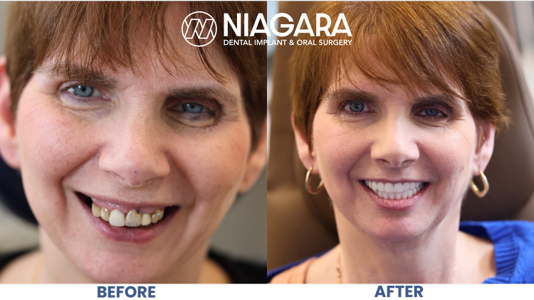 Comparison of teeth before and after dental treatment, showing improved teeth alignment and whitening, with the before image showing misaligned and discolored teeth and the after image showing straight, white teeth. The image is branded for NDIOS