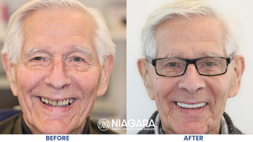 White Black Modern Photo Collage Before After Youtube Thumbnail (1).png